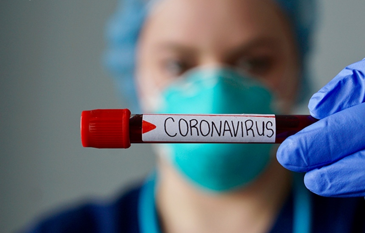 coronavirus-epis.jpg